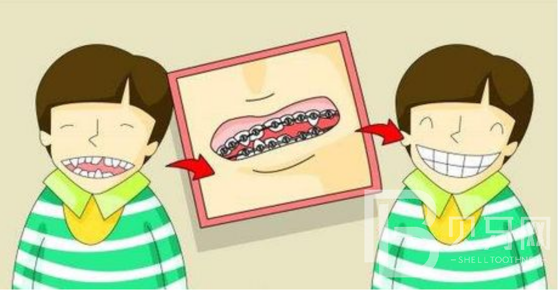 孩子牙齒不齊可以做牙齒矯正嗎？