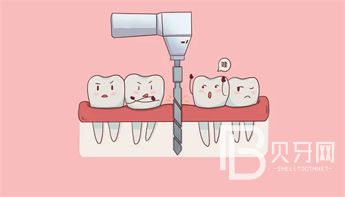 盤點(diǎn)上?？谇慌琶笆t(yī)院！治牙齒找放心醫(yī)院！