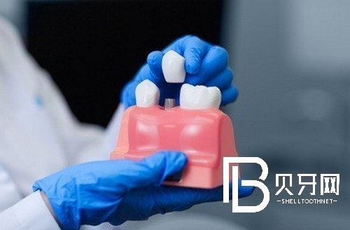 上海雅悅口腔怎么樣，聽說做種植牙醫(yī)生技術(shù)不錯(cuò)？