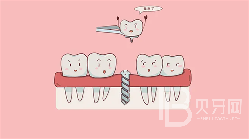 上海華齒口腔做牙收費(fèi)貴嗎？看看診療價(jià)格這幾項(xiàng)很便宜！