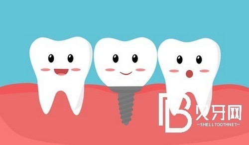 上海黃浦區(qū)種植牙價(jià)格表，種牙好又便宜的牙科