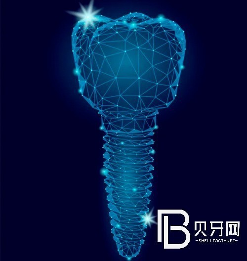 上海拜博口腔種植牙價(jià)目表，包含韓國(guó)，瑞士種植系統(tǒng)價(jià)格