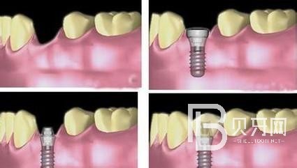 北京固爾口腔怎么樣？收費(fèi)怎么樣？