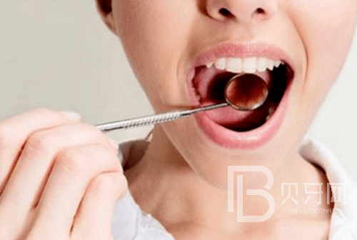 上?？谇会t(yī)院哪家好？上海圣貝口腔的口碑怎么樣？