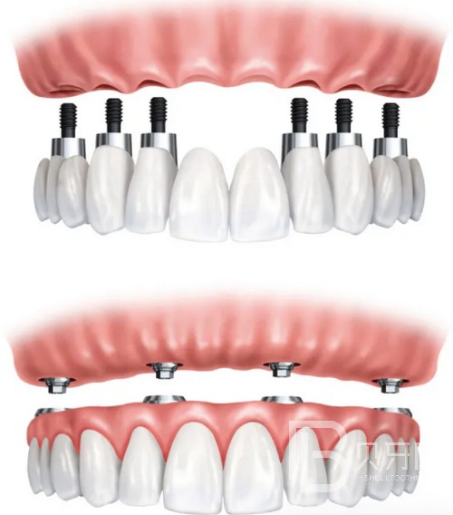 南京康美口腔好不好？收費貴嗎？公布具體地址