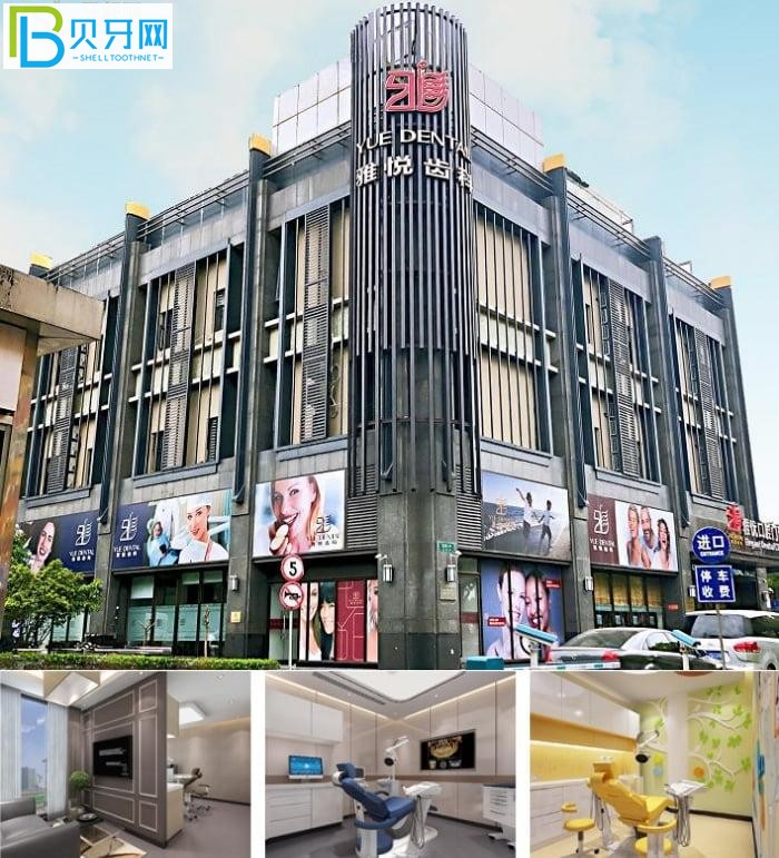 上海雅悅齒科種牙怎么樣?看上海當?shù)厝嗽u價好用不貴還不疼!