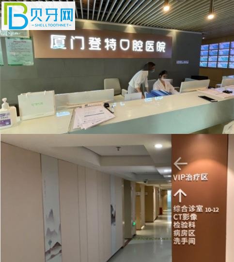 登特牙齒不到半個(gè)小時(shí)就搞定了，你知道嗎？