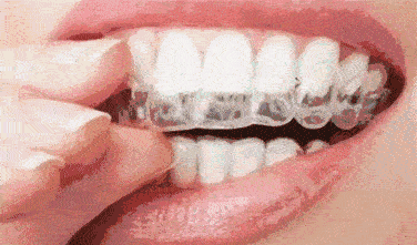 北京中諾口腔醫(yī)院種植牙技術(shù)好的醫(yī)院，好口碑不是空穴來(lái)風(fēng)