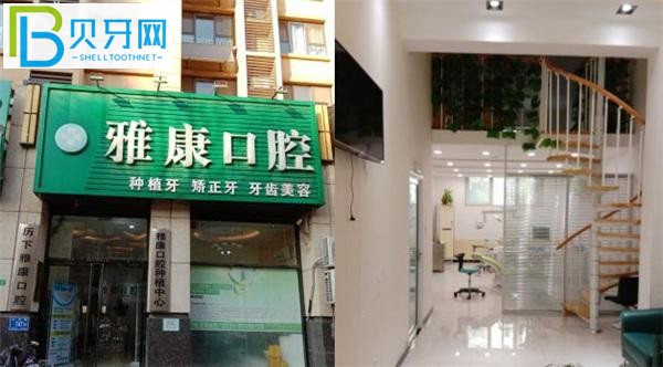 濟南雅康口腔種植牙好嗎