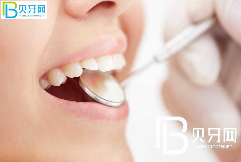 深圳寶港口腔怎么樣？醫(yī)院靠譜嗎？