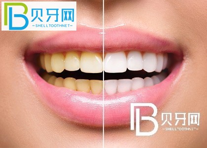 上海瑞爾齒科怎么樣？口碑如何？附上海各門店地址