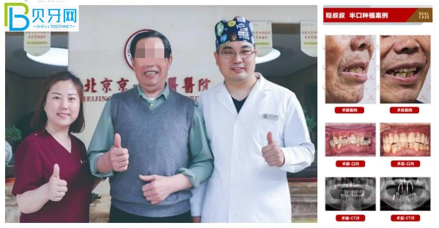 北京京一中醫(yī)醫(yī)院看牙好不好