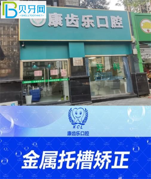 杭州康齒樂口腔收費標準價格表