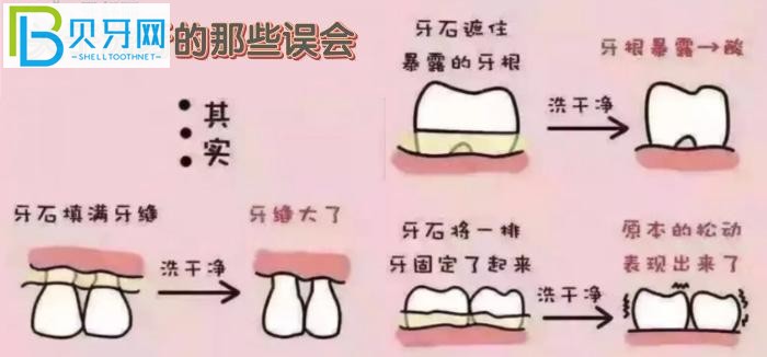 萬(wàn)州牙科醫(yī)院哪里好？推薦品善和牙博士?jī)杉铱诒玫难揽圃\所給你！
