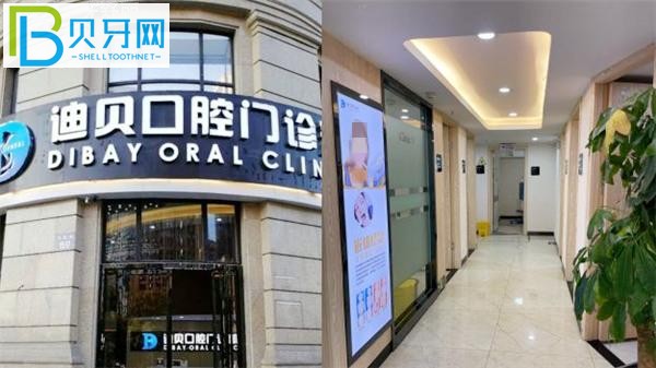 杭州迪貝口腔收費(fèi)標(biāo)準(zhǔn)價(jià)格表貴嗎