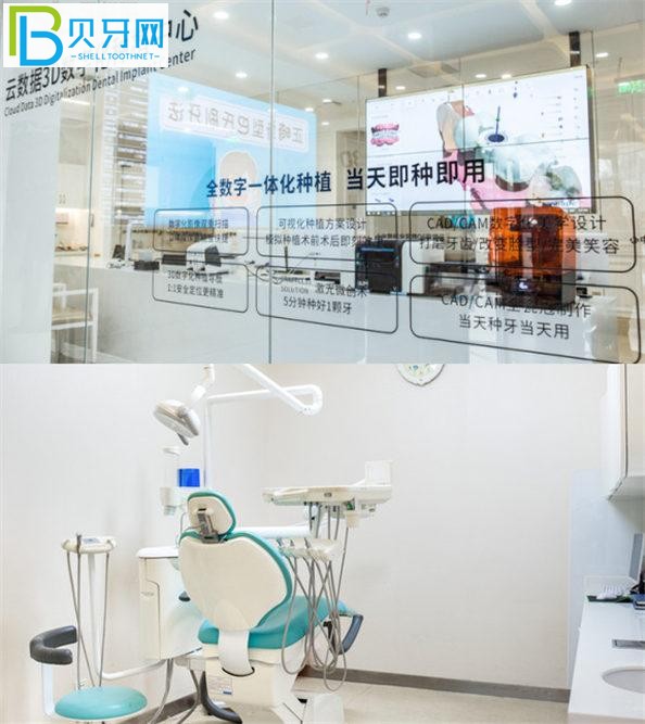 去過才知道西安團圓口腔種植牙好不好 正規(guī)價格實惠口碑強