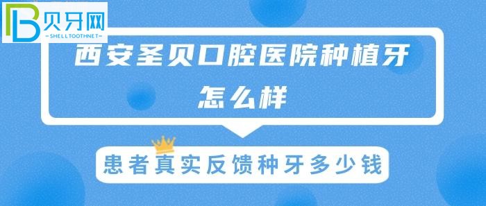 西安圣貝種植牙怎么樣，患者真實(shí)反饋種牙多少錢？(圖)