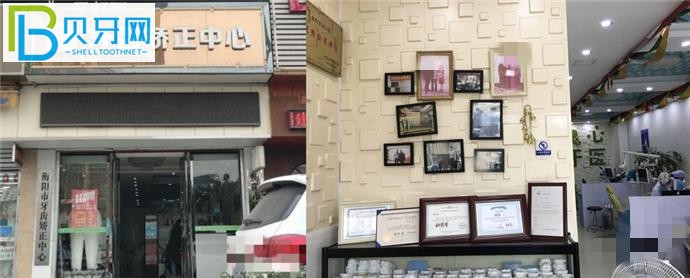 衡陽寶島口腔矯正價(jià)格