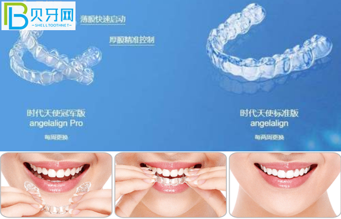 珠海隱形牙套哪家醫(yī)院比較好?推薦暨博口腔技術(shù)好價不高!