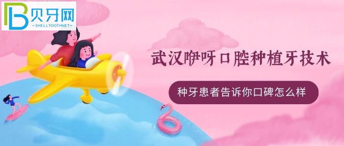 All-on-4/6種植牙技術(shù)好不好？(組圖)