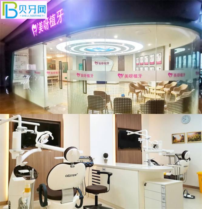 上海美呀口腔種植牙正規(guī)嗎