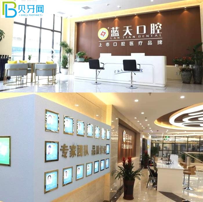 玉林口腔醫(yī)院哪個好?當(dāng)?shù)卦u價(jià)藍(lán)天口腔醫(yī)院正規(guī)靠譜技術(shù)好