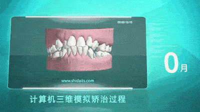 暨南大學(xué)穗華口腔醫(yī)院怎么樣