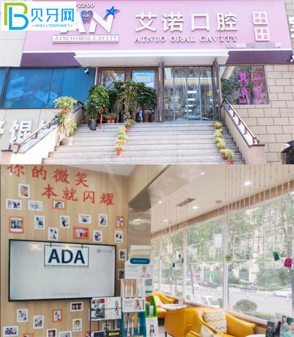 青島艾諾口腔怎么樣 艾諾口腔參考價格