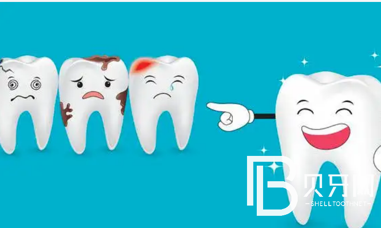 廣州瑞爾齒科怎么樣？看牙貴不貴？