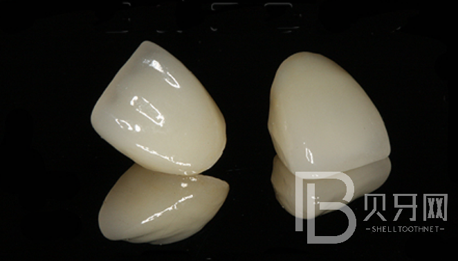 成都牙米口腔正規(guī)嗎？種植牙實力醫(yī)生推薦