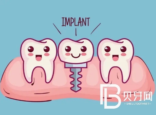 廣州柏德口腔種植牙好不好？收費(fèi)貴不貴？