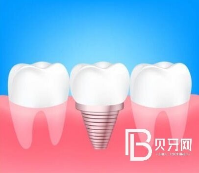 杭州博泰口腔口碑怎么樣？醫(yī)院正規(guī)嗎？