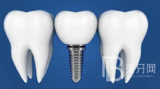 廣州致美口腔正規(guī)靠譜嗎？廣州致美口腔醫(yī)院位置在哪？