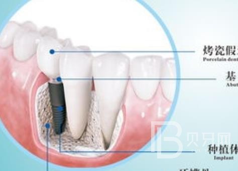 廣州優(yōu)德口腔正規(guī)靠譜嗎？廣州優(yōu)德口腔醫(yī)院位置在哪？