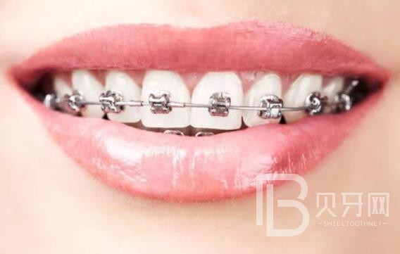 廣州明瑞口腔怎么樣？廣州明瑞口腔口碑好不好？廣州明瑞口腔種植牙多少錢