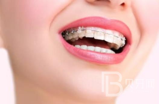 廣州潤(rùn)博口腔正規(guī)靠譜嗎？廣州潤(rùn)博口腔醫(yī)院位置在哪？