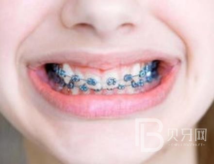 廣州團(tuán)圓口腔怎么樣？廣州團(tuán)圓口腔種植牙一顆多少錢