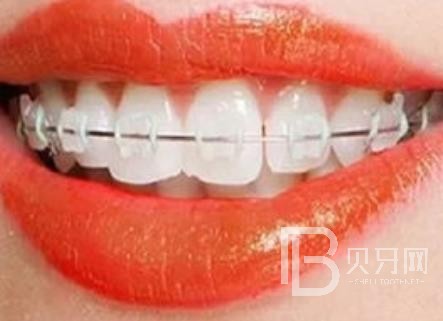 廣州愛(ài)頓口腔怎么樣？廣州愛(ài)頓口腔口碑好不好？廣州愛(ài)頓口腔種植牙價(jià)格