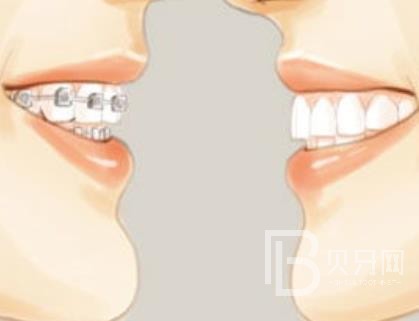 廣州雅皓口腔正規(guī)靠譜嗎？廣州雅皓口腔醫(yī)院位置在哪？