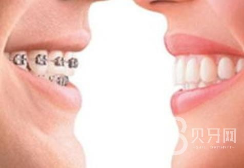 廣州歐立口腔怎么樣？廣州歐立口腔口碑好不好？廣州歐立口腔種植牙價(jià)格