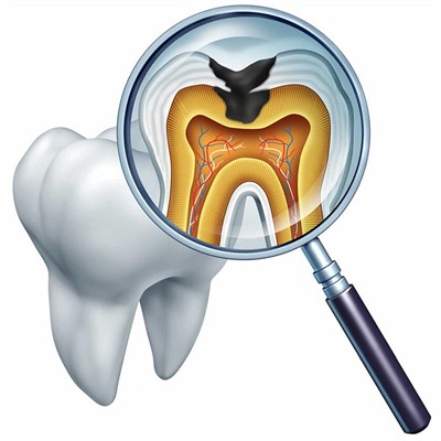 杭州種植一顆假牙多少錢！杭州張永珍口腔診所種植牙價格表參考，瑞典諾貝爾Active種植牙：13390元起/顆！