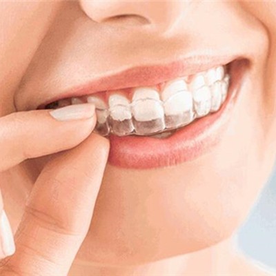 杭州種一顆牙要多少錢！杭州富陽昌華口腔診所種植牙醫(yī)院排名TOP1，德國卡瓦ABT種植體：6439元起/顆！