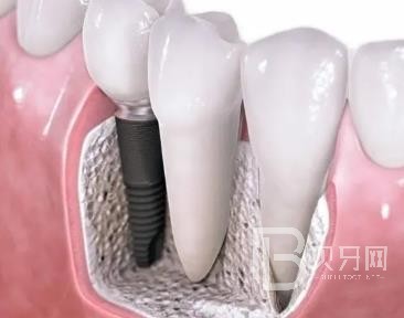 廣州牙美佳口腔正規(guī)靠譜嗎？廣州牙美佳口腔醫(yī)院位置在哪？