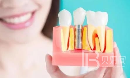 廣州全明口腔怎么樣？廣州全明口腔種植牙一顆多少錢