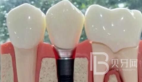 廣州華晨口腔正規(guī)靠譜嗎？廣州華晨口腔醫(yī)院位置在哪？