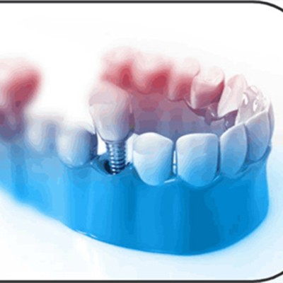 寧波補(bǔ)牙牙科醫(yī)院排名榜公布（最新）！寧波江北康樂(lè)口腔門(mén)診部實(shí)力值得信賴(lài)！