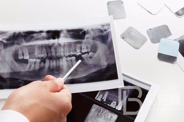 到底種植牙好還是鑲牙好？北京王府井口腔怎么樣？