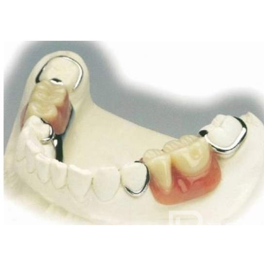 杭州種植一顆假牙多少錢！杭州潔奧口腔門診部(蕭山區(qū))種植牙價格表更新，國產(chǎn)康盛種植牙價格：3836元起/顆！