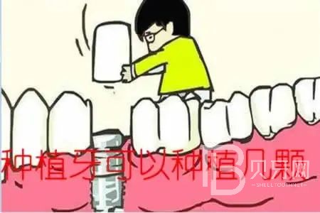 allon6種植牙是什么意思？東莞拜爾口腔