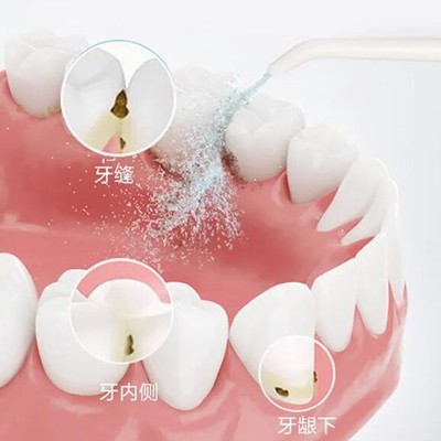 湖州韓國種牙口腔醫(yī)院排名前十榜單2023公布！湖州富民門診部實(shí)力強(qiáng)更安全！